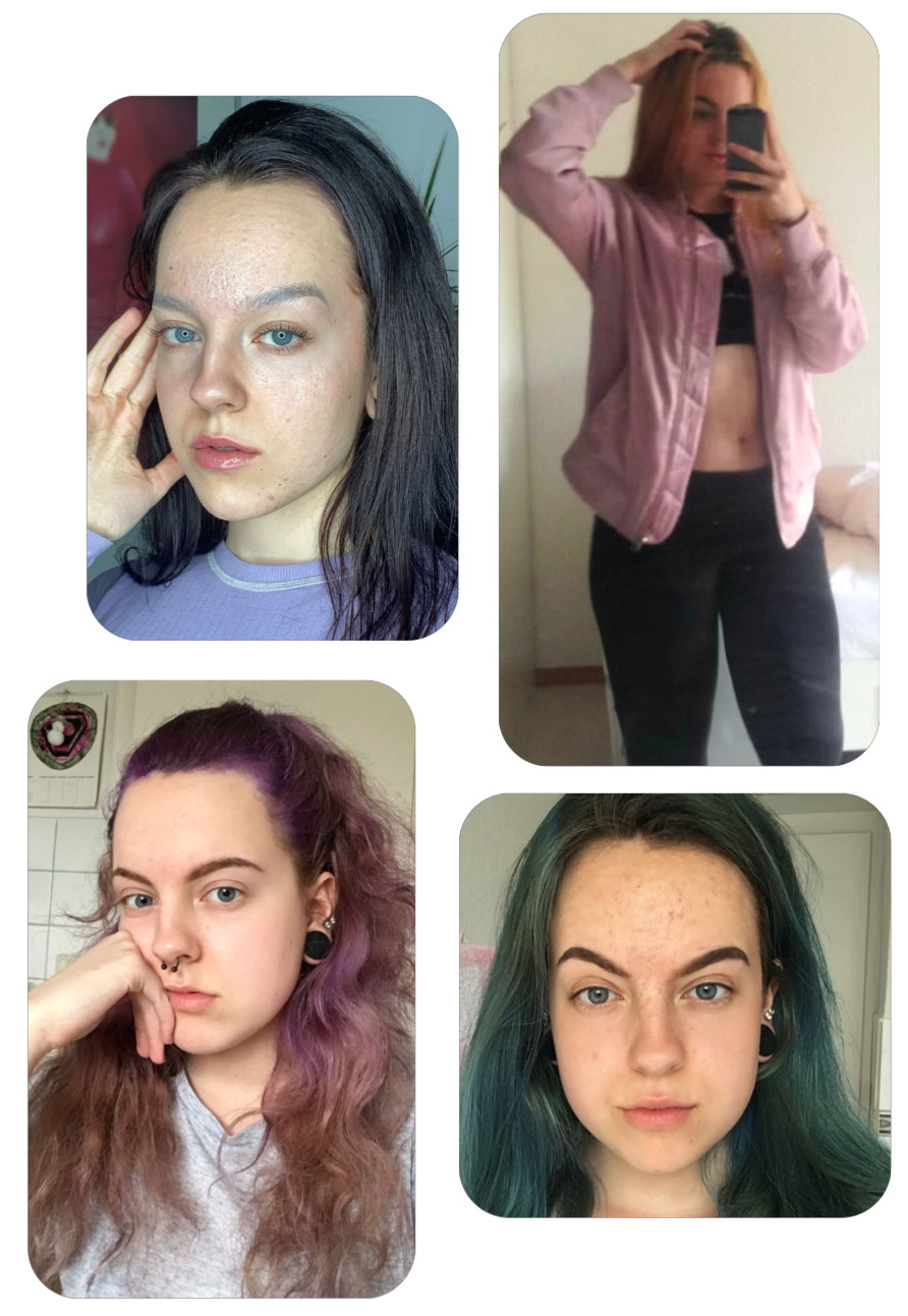 Vorher Bilder Mailin